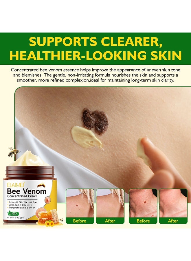 Elaimei Bee Venom Skin Restoration Cream, Bee Venom Concentrated Cream, Bee Venom Wart Removal Cream, Wart Removal Freezer, Wart Removal Cream, Skin Tag Removal, Painless Removal Of Skin Tags And Moles, 120G - Image 3